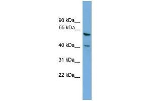 PINX1 antibody used at 0. (PINX1 anticorps  (Middle Region))
