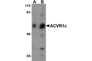 Western blot analysis of ACVR1C in human placenta tissue lysate with AP30016PU-N ACVR1C antibody at (A) 1 and (B) 2 μg/ml. (ACVR1C/ALK7 anticorps  (N-Term))