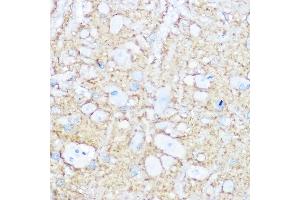 Immunohistochemistry of paraffin-embedded rat brain using NC / CD56 Rabbit pAb (ABIN6127607, ABIN6144393, ABIN6144395 and ABIN6223907) at dilution of 1:100 (40x lens). (CD56 anticorps  (AA 759-858))