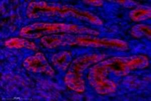 Immunofluorescent analysis of paraformaldehyde-fixed mouse uterus using,NCKAP1 (ABIN7074784) at dilution of 1: 1000 (NCKAP1 anticorps)