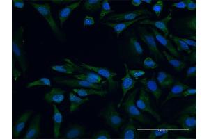 Immunofluorescence of purified MaxPab antibody to SMN2 on HeLa cell. (SMN2 anticorps  (AA 1-282))