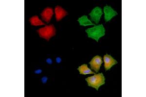 ABIN6257942 and ABIN6275202 staining  cells by IF/ICC. (AASDHPPT anticorps  (C-Term))