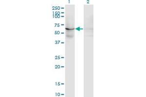 Western Blot analysis of EFHC1 expression in transfected 293T cell line by EFHC1 monoclonal antibody (M09), clone 4E7.