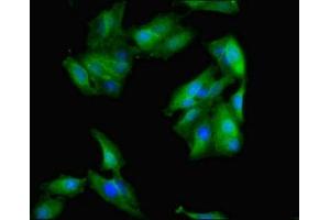 Immunofluorescent analysis of Hela cells using ABIN7142719 at dilution of 1:100 and Alexa Fluor 488-congugated AffiniPure Goat Anti-Rabbit IgG(H+L) (RPLP0 anticorps  (AA 1-317))