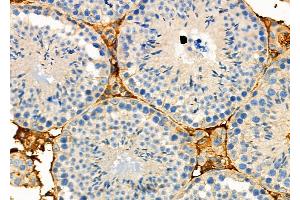ABIN6263947 and ABIN6272732 at 1/100 staining Mouse testis tissue by IHC-P.