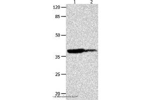 Western blot analysis of Human leiomyosarcoma and liver cancer tissue  , using LPAR4 Polyclonal Antibody at dilution of 1:450 (LPAR4 anticorps)