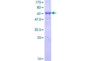Image no. 1 for Pyruvate Dehydrogenase Kinase, Isozyme 4 (PDK4) (AA 1-411) protein (GST tag) (ABIN1314556)