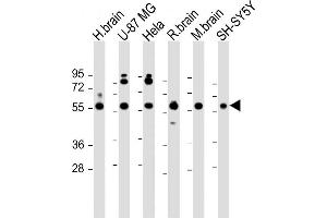 All lanes : Anti-GDI1 Antibody (C-term) at 1:2000 dilution Lane 1: human brain lysate Lane 2: U-87 MG whole cell lysate Lane 3: Hela whole cell lysate Lane 4: rat brain lysate Lane 5: mouse brain lysate Lane 6: SH-SY5Y whole cell lysate Lysates/proteins at 20 μg per lane. (GDI1 anticorps  (C-Term))