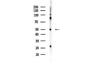 anti-Chromosome 9 Open Reading Frame 156 (C9orf156) (Internal Region) antibody