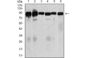 Western Blotting (WB) image for anti-Transforming Growth Factor, beta Receptor III (TGFBR3) (AA 147-328) antibody (ABIN1846465)