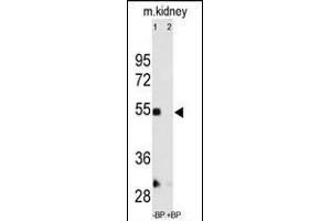 Western blot analysis of anti-hP12- Pab (ABIN390136 and ABIN2840640) pre-incubated without(lane 1) and with(lane 2) blocking peptide in mouse kidney tissue lysates.