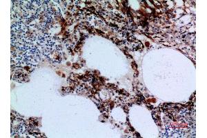 Immunohistochemistry (IHC) analysis of paraffin-embedded Human Lung, antibody was diluted at 1:100. (17beta-HSD4 (N-Term) anticorps)