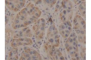 DAB staining on IHC-P; Samples: Human Liver Tissue