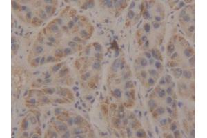DAB staining on IHC-P; Samples: Human Liver Tissue (Manic Fringe anticorps  (AA 80-316))