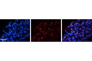 Rabbit Anti-WWP1 Antibody     Formalin Fixed Paraffin Embedded Tissue: Human Pineal Tissue  Observed Staining: Nuclear in pinealocytes  Primary Antibody Concentration: 1:100  Secondary Antibody: Donkey anti-Rabbit-Cy3  Secondary Antibody Concentration: 1:200  Magnification: 20X  Exposure Time: 0. (WWP1 anticorps  (N-Term))