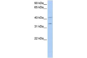 WB Suggested Anti-LASP1 Antibody Titration: 0. (LASP1 anticorps  (Middle Region))