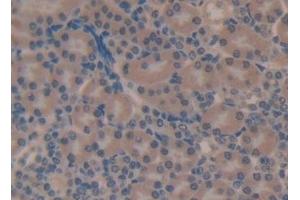 Detection of C4 in Mouse Kidney Tissue using Polyclonal Antibody to Complement Component 4 (C4)
