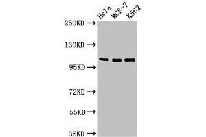Western Blot Positive WB detected in: Hela whole cell lysate, MCF-7 whole cell lysate, K562 whole cell lysate All lanes: EVC antibody at 2 μg/mL Secondary Goat polyclonal to rabbit IgG at 1/50000 dilution Predicted band size: 112 kDa Observed band size: 112 kDa (EVC anticorps  (AA 493-602))