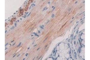 Detection of HLA-DRB1 in Mouse Small intestine Tissue using Polyclonal Antibody to HLA Class II Histocompatibility Antigen, DRB1 Beta Chain (HLA-DRB1)