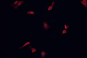 ABIN6266622 staining CACO-2 cells by IF/ICC. (PDGFRA anticorps  (Internal Region))
