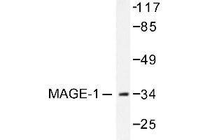Image no. 1 for anti-Melanoma Antigen Family A, 1 (Directs Expression of Antigen MZ2-E) (MAGEA1) antibody (ABIN265510) (MAGEA1 anticorps)