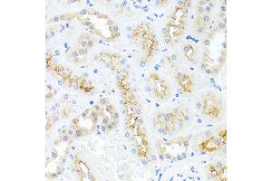 Immunohistochemistry of paraffin-embedded rat kidney using IL8 antibody at dilution of 1:100 (x40 lens). (IL-8 anticorps)