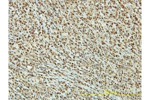 anti-TP53 Regulating Kinase (TP53RK) (AA 1-253) antibody