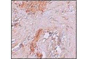Immunohistochemistry of RBM35A in Human colon tissue with RBM35A antibody at 2. (ESRP1 anticorps  (N-Term))
