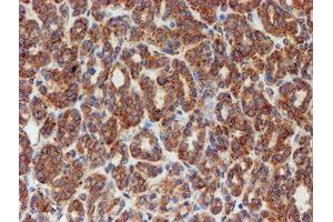 Image no. 8 for anti-Sec1 Family Domain Containing 1 (SCFD1) antibody (ABIN1500819)