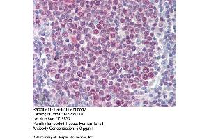 Immunohistochemistry with Human Tonsil lysate tissue at an antibody concentration of 5. (TGFB1I1 anticorps  (N-Term))