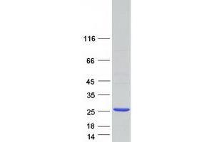 Validation with Western Blot