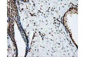 Immunohistochemical staining of paraffin-embedded colon tissue using anti-NIT2 mouse monoclonal antibody.
