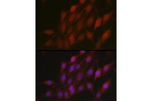Immunofluorescence analysis of C6 cells using β-TrCP/BTRC Rabbit pAb (ABIN3022333, ABIN3022334, ABIN3022335 and ABIN6218745) at dilution of 1:100 (40x lens). (BTRC anticorps  (AA 50-340))