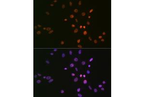 Immunofluorescence analysis of NIH-3T3 cells using SMC1 Rabbit mAb (ABIN7270614) at dilution of 1:100 (40x lens). (SMC1A anticorps)