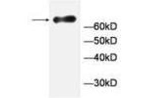 Image no. 1 for anti-General Transcription Factor IIA, 1-Like (GTF2A1L) antibody (ABIN791472) (GTF2A1L anticorps)