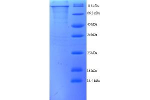 SDS-PAGE (SDS) image for Selenoprotein X, 1 (SEPX1) (AA 26-760) protein (GST tag) (ABIN5709499) (MSRB1 Protein (AA 26-760) (GST tag))