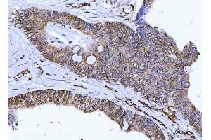 IHC analysis of Nesprin 2/SYNE2 using anti-Nesprin 2/SYNE2 antibody (ABIN7601532).