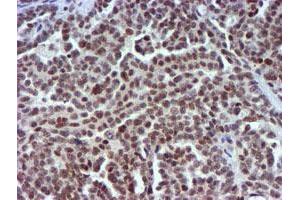 Image no. 6 for anti-Ubiquitin Specific Peptidase 7 (Herpes Virus-Associated) (USP7) antibody (ABIN1498592) (USP7 anticorps)