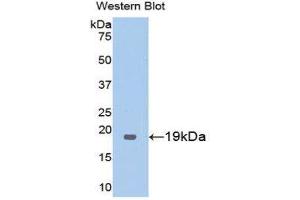 Western Blotting (WB) image for anti-Thrombomodulin (THBD) (AA 325-481) antibody (ABIN1173036) (Thrombomodulin anticorps  (AA 325-481))