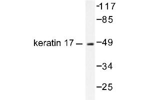 Image no. 1 for anti-Keratin 17 (KRT17) antibody (ABIN265496) (KRT17 anticorps)