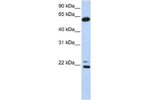 WB Suggested Anti-CCT5 Antibody Titration: 0. (CCT5 anticorps  (C-Term))