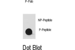 Dot Blot (DB) image for anti-V-Yes-1 Yamaguchi Sarcoma Viral Oncogene Homolog 1 (YES1) (pTyr530), (pTyr537) antibody (ABIN5978609) (YES1 anticorps  (pTyr530, pTyr537))