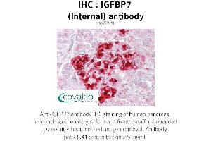 Image no. 1 for anti-Insulin-Like Growth Factor Binding Protein 7 (IGFBP7) (Internal Region) antibody (ABIN1735789) (IGFBP7 anticorps  (Internal Region))