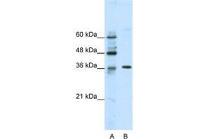 WB Suggested Anti-ZNF124 Antibody Titration:  2. (ZNF124 anticorps  (N-Term))