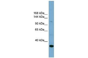 WB Suggested Anti-SLC9A1 Antibody Titration:  0. (SLC9A1 anticorps  (Middle Region))