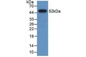 Western Blot; Sample: Recombinant FPN, Human. (SLC40A1 anticorps  (AA 127-321))