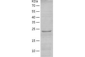 Western Blotting (WB) image for Nicotinamide Nucleotide Adenylyltransferase 1 (NMNAT1) (AA 1-279) protein (His-IF2DI Tag) (ABIN7124171)