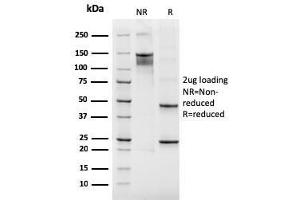 SDS-PAGE Analysis Purified CD61 Recombinant Mouse Monoclonal Antibody (rITGB3/2145).