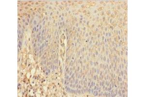 Immunohistochemistry of paraffin-embedded human tonsil tissue using ABIN7144104 at dilution of 1:100 (ANGPTL2 anticorps  (AA 23-493))