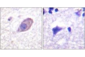 Immunohistochemistry analysis of paraffin-embedded human brain tissue, using Kir5.